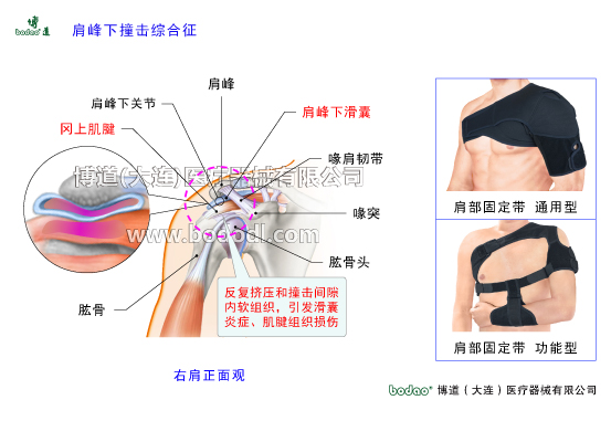 肩关节的常见疾病与健康防护