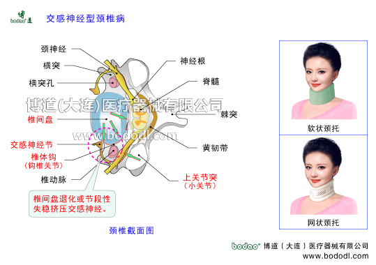 交感神经型颈椎病的发病原因与症状颈椎综合症的预防与治疗博道颈椎固定带与矫正带种类和功能颈椎间盘突出颈椎节段失稳挤压交感神经颈神经横突椎体前纵韧带交感神经节椎体钩钩椎关节椎动脉上关节突颈椎小关节黄韧带棘突脊髓神经根透气围领护颈颈椎矫正固定支架支具高度可调节颈椎矫正牵引固定带颈椎术后康复矫正固定支具颈椎骨折急救固定支博道颈椎矫正带脊髓神经颈椎劳损颈椎不稳