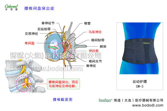 腰椎部的运动损伤与防护