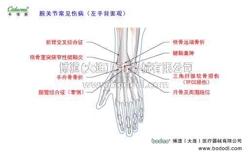 腕关节的运动损伤与防护