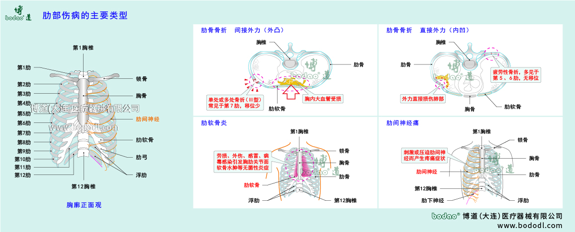 肋部伤病的类型与症状