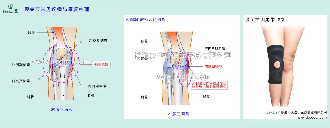 膝の主な疾患