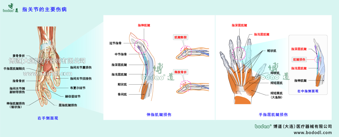 指关节伤病的类型与症状